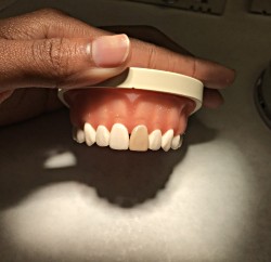 Chione model teeth